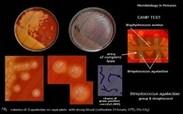 streptococcus agalactiae